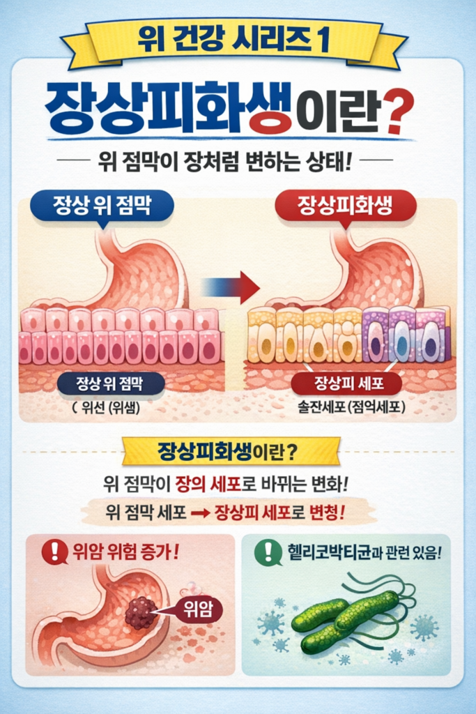 장상피화생이 정상 위 점막이 장 세포 형태로 변화하는 과정과 특징을 비교하여 설명한 위 건강 시리즈