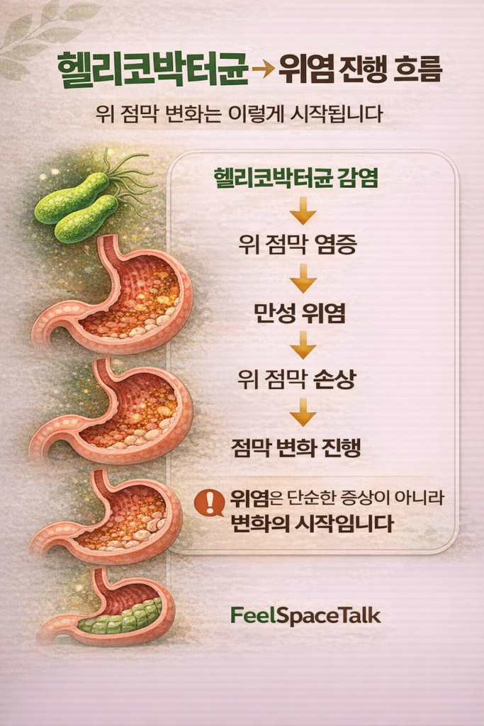 헬리코박터균 감염부터 위 점막 염증, 만성 위염, 점막 손상, 점막 변화로 이어지는 과정을 단계별로 보여주는 세로형 인포그래픽 이미지.